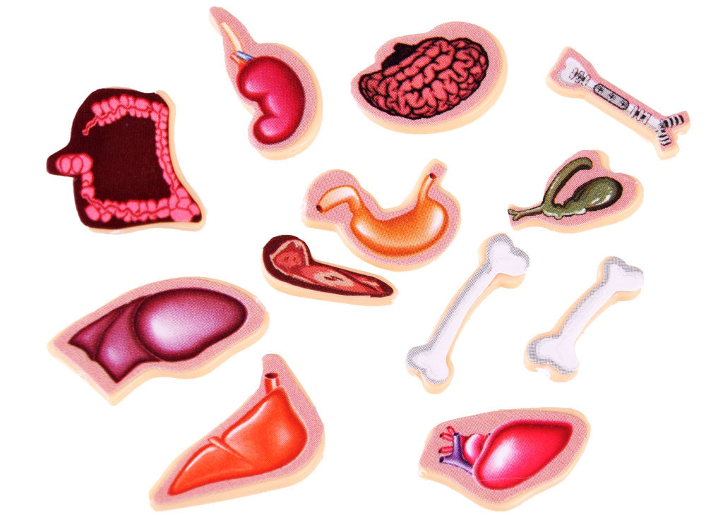 Arkadinis žaidimas „Operacija“