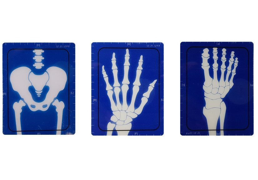 Medicinos žaidimų rinkinys Rentgeno aparatas su priedais